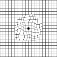 中心がぼやけて見える　又は暗く見える