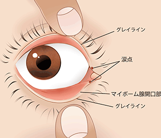 だけ 涙 片目 片目から涙が出ます